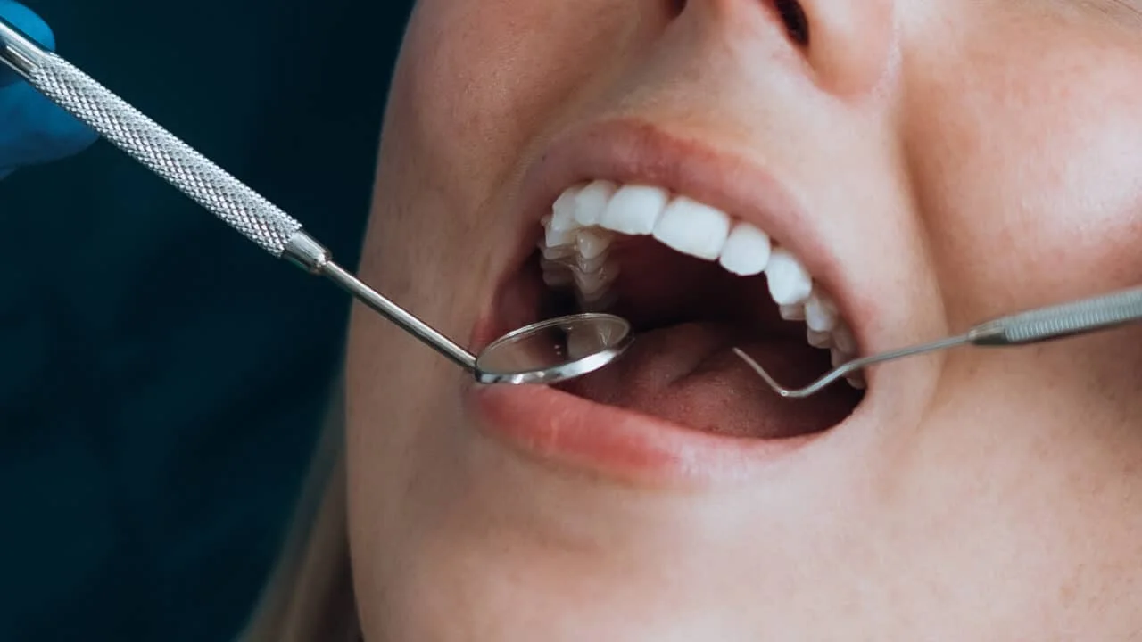 drjameslapierre Extractions